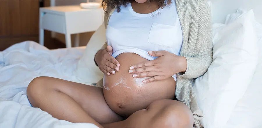 How to prevent stretch marks during pregnancy - Cradle & Tonic