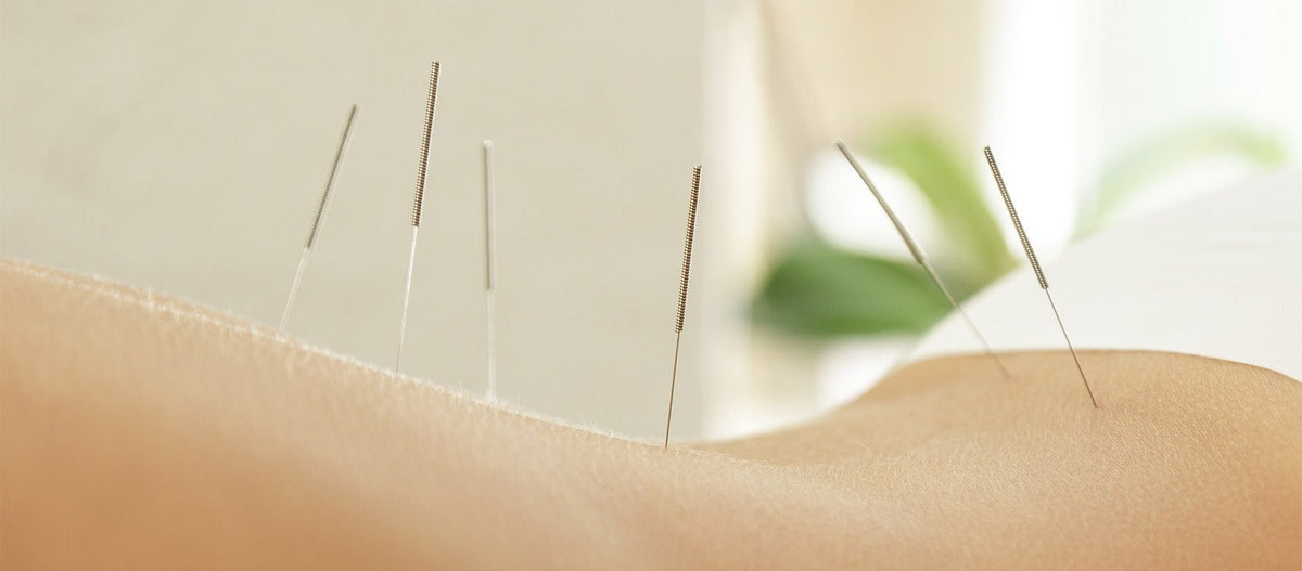 Acupuncture for Fertility