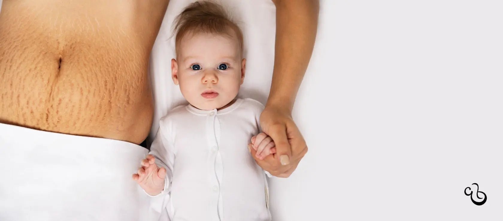 Why do some women get stretch marks? - Cradle & Tonic